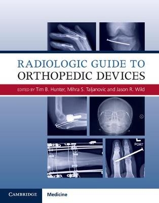 Radiologic Guide to Orthopedic Devices - 