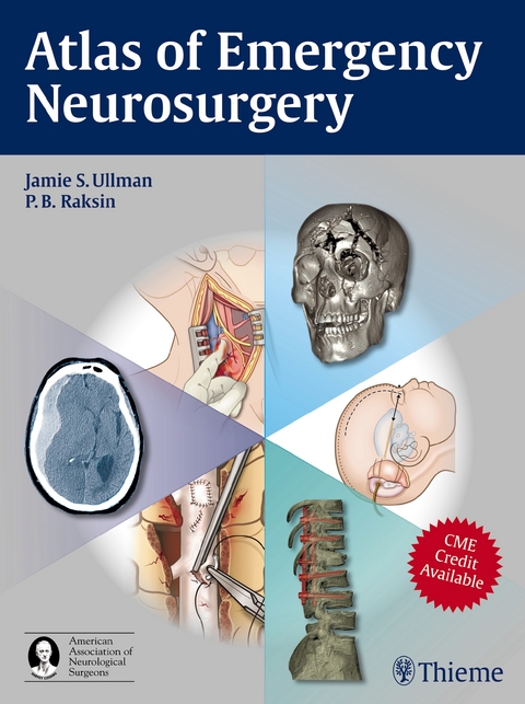Atlas of Emergency Neurosurgery - 