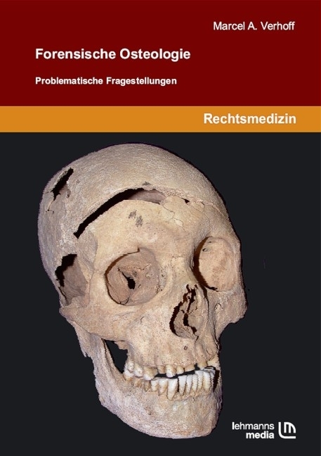 Forensische Osteologie - Marcel A Verhoff