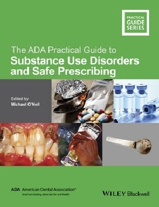 The ADA Practical Guide to Substance Use Disorders and Safe Prescribing - 