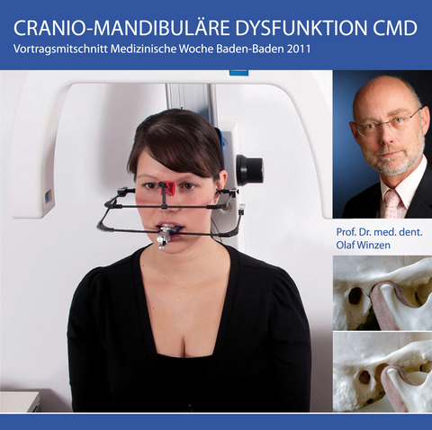 Craniomandibuläre Dysfunktion-CMD - 