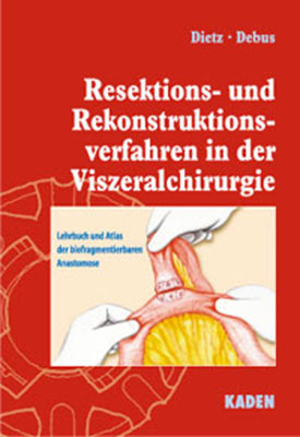 Resektions- und Rekonstruktionsverfahren in der Viszeralchirurgie - Ulrich A Dietz; Eike S Debus