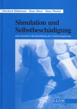 Simulation und Selbstbeschädigung - Eberhard Hildebrand; Klaus Hitzer; Klaus Püschel