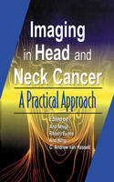 Imaging of Head and Neck Cancer - 