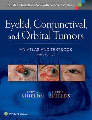 Eyelid, Conjunctival, and Orbital Tumors: An Atlas and Textbook -  Carol L. Shields,  Jerry A. Shields