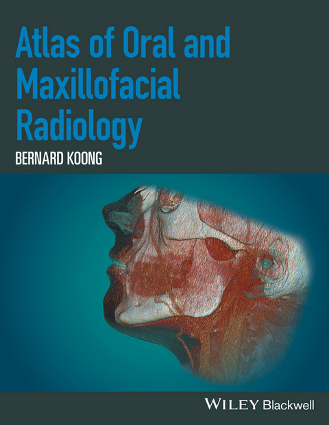 Atlas of Oral and Maxillofacial Radiology -  Bernard Koong