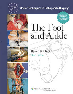 Master Techniques in Orthopaedic Surgery: Foot and Ankle -  Harold Kitaoka