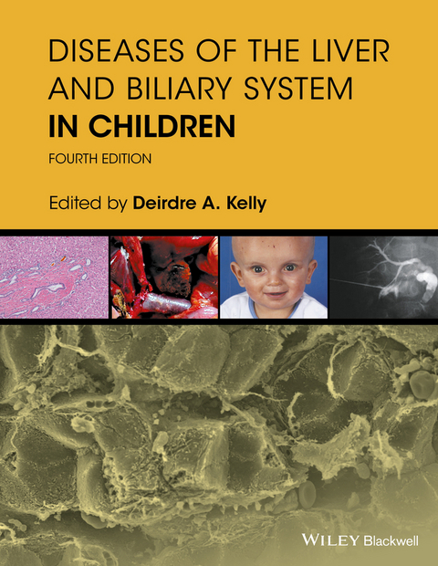 Diseases of the Liver and Biliary System in Children - 