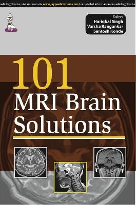 101 MRI Brain Solutions - Hariqbal Singh, Varsha Angankar, Santosh Konde