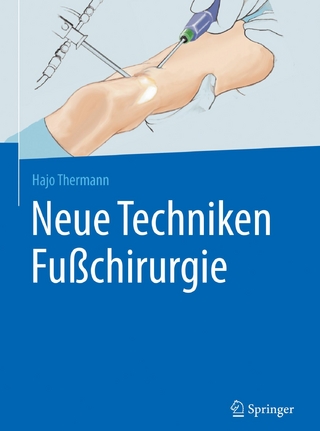 Neue Techniken Fußchirurgie - Hajo Thermann