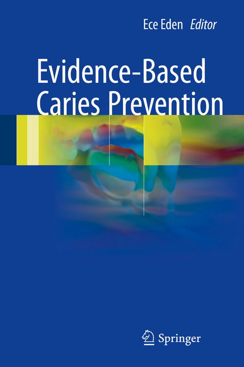 Evidence-Based Caries Prevention - 