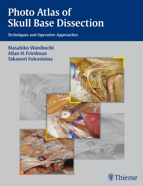Photo Atlas of Skull Base Dissection - Masahiko Wanibuchi, Allan H. Friedman, Takanori Fukushima