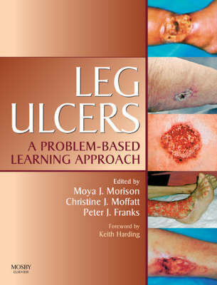 Leg Ulcers E-Book - Peter Franks; Christine Moffatt; Moya Morison