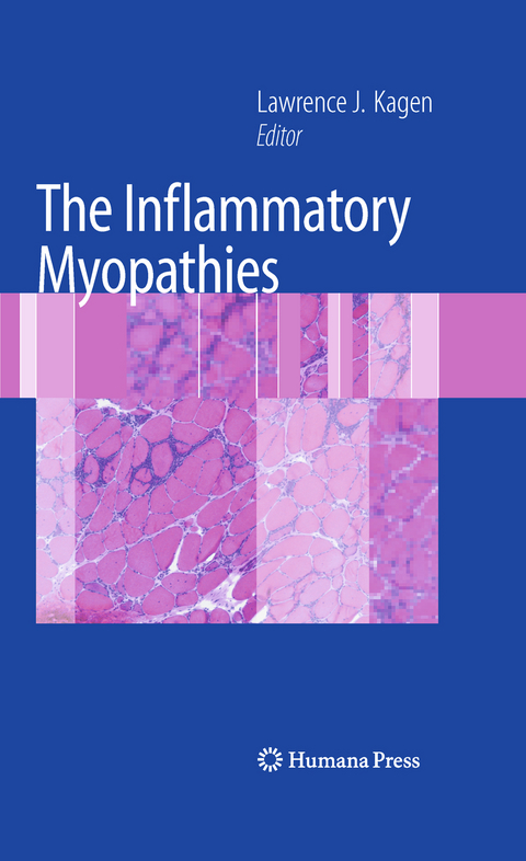 The Inflammatory Myopathies - 