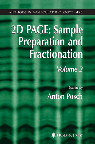 2D PAGE: Sample Preparation and Fractionation - Anton Posch