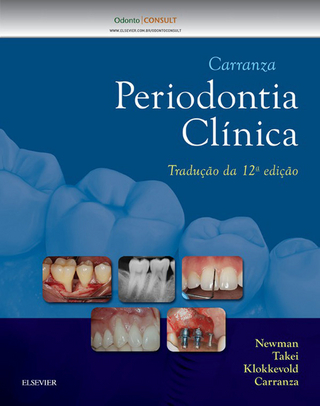 Carranza Periodontia Clinica - Fermin A. Carranza; Perry R. Klokkevold; Michael G. Newman; Henry Takei