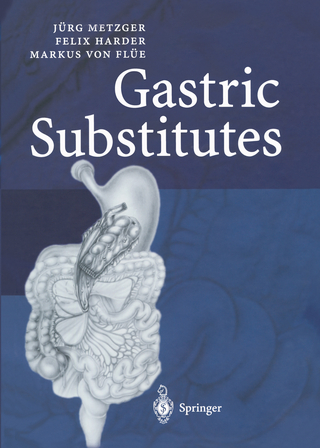 Gastric Substitutes - Jürg Metzger; Felix Harder; Markus von Flüe