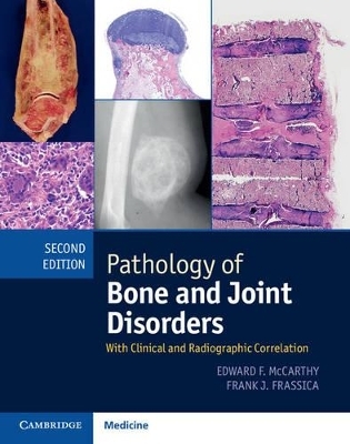 Pathology of Bone and Joint Disorders Print and Online Bundle - Edward F. McCarthy, Frank J. Frassica