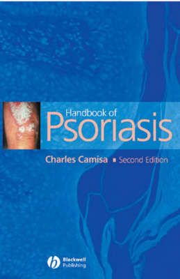 Handbook of Psoriasis - Charles Camisa