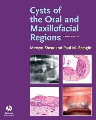 Cysts of the Oral and Maxillofacial Regions - Mervyn Shear, Paul Speight