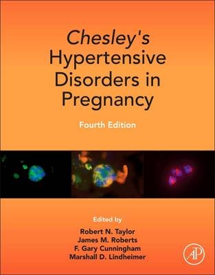Chesley's Hypertensive Disorders in Pregnancy - Robert N. Taylor; James M. Roberts; Gary F. Cunningham; Marshall D. Lindheimer
