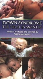 Down Syndrome - Will Schermerhorn