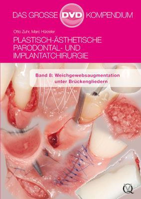 Plastisch-Ästhetische Parodontal- und Implantatchirurgie / Plastisch-Ästhetische Parodontal- und Implantatchirurgie - Otto Zuhr, Marc Hürzeler
