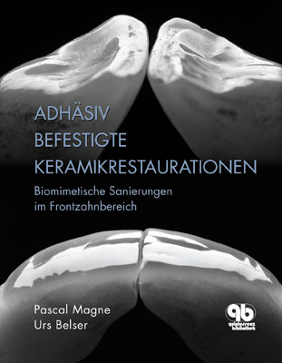 Adhäsiv befestigte Keramikrestaurationen im Frontzahnbereich - Urs C. Belser; Pascal Magne