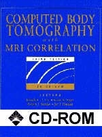 Computed Body Tomography with MRI Correlation - 