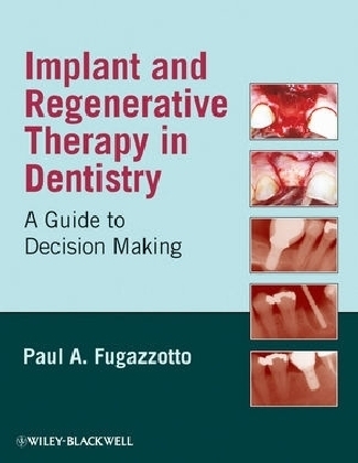 Implant and Regenerative Therapy in Dentistry - Paul A. Fugazzotto