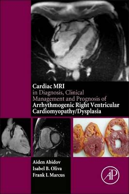 Cardiac MRI in Diagnosis, Clinical Management, and Prognosis of Arrhythmogenic Right Ventricular Cardiomyopathy/Dysplasia -  Aiden Abidov,  Frank I Marcus,  Isabel Oliva
