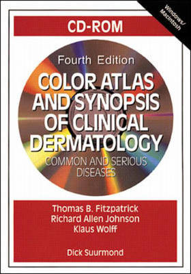 Color Atlas and Synopsis of Clinical Dermatology - 