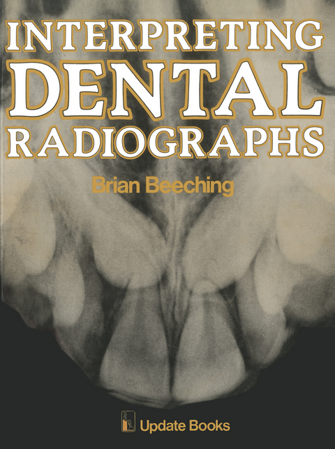 Interpreting Dental Radiographs - B.W. Beeching