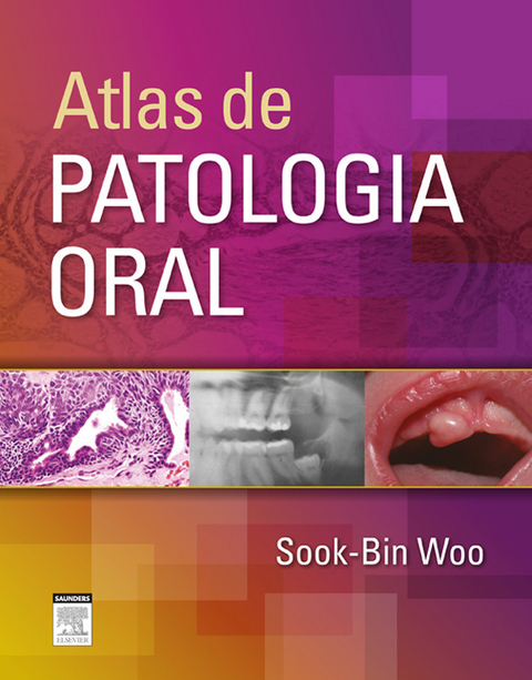 papiloma fibroepitelial escamoso)
