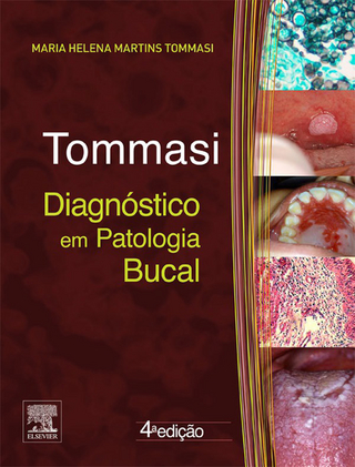 Diagnostico em Patologia Bucal - Antonio Fernando Tommasi; Maria Helena Tommasi