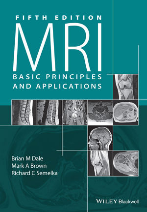 MRI -  Mark A. Brown,  Brian M. Dale,  Richard C. Semelka