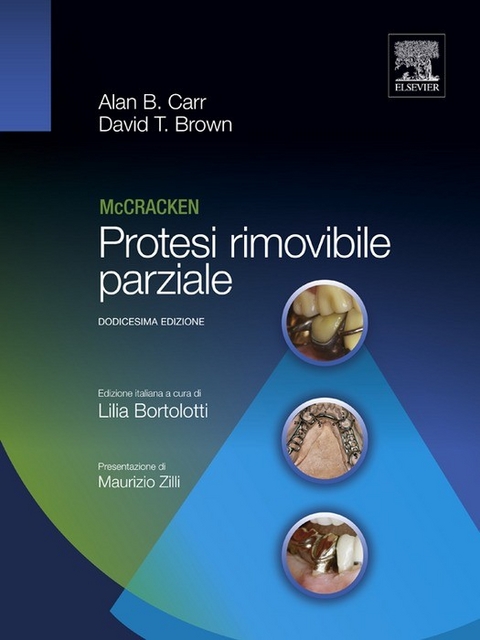 Mc Cracken Protesi rimovibile parziale -  A. B. Carr,  D. T. Brown
