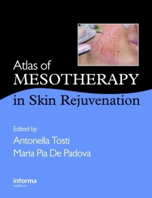Atlas of Mesotherapy in Skin Rejuvenation - Antonella Tosti; Maria Pia De Padova