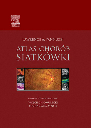 Atlas chorób siatkówki - Lawrence A. Yannuzzi