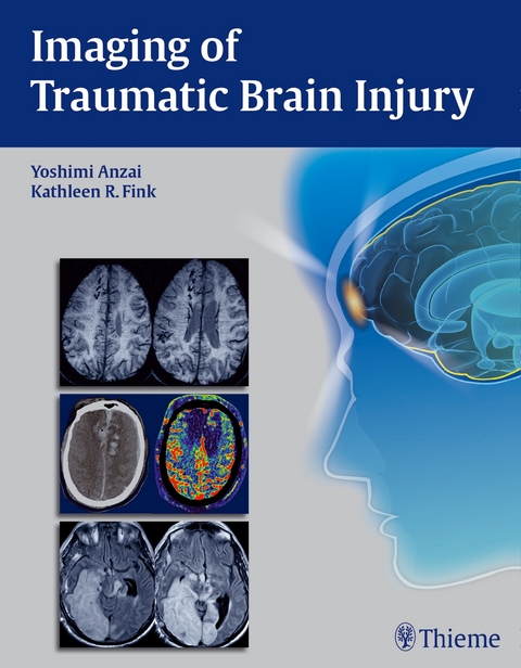 Imaging of Traumatic Brain Injury - 