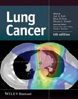 Lung Cancer - Jack A. Roth; Waun Ki Hong; Ritsuko U. Komaki
