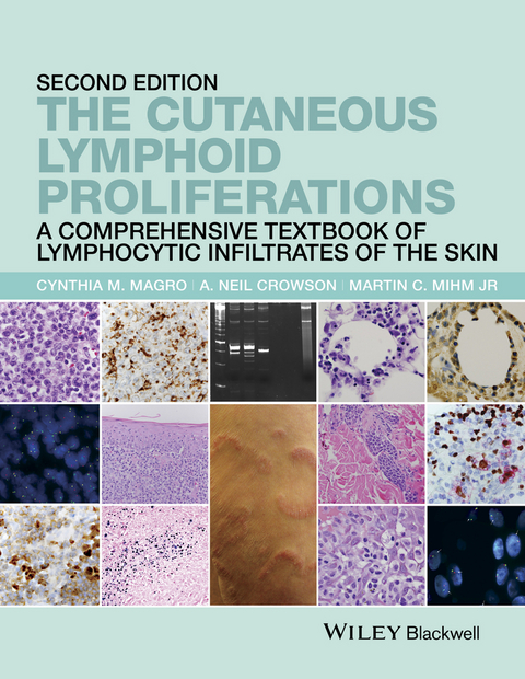 Cutaneous Lymphoid Proliferations -  A. Neil Crowson,  Cynthia M. Magro,  Jr Martin C. Mihm