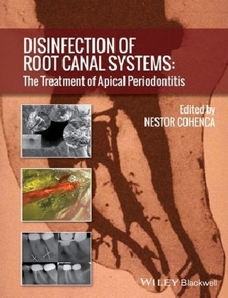 Disinfection of Root Canal Systems - Nestor Cohenca