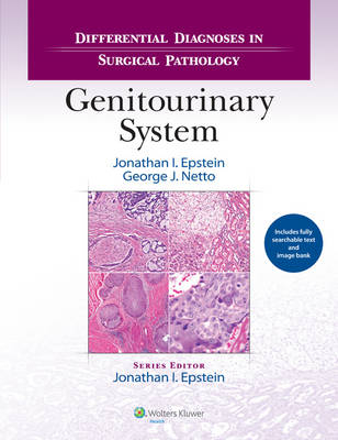 Differential Diagnoses in Surgical Pathology: Genitourinary System - Jonathan I. Epstein, George J. Netto