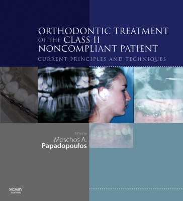 Orthodontic Treatment of the Class II Non-Compliant Patient - Moschos A. Papadopoulos