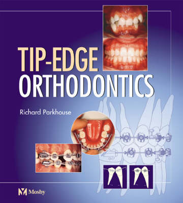 Tip-edge Orthodontics - Richard Parkhouse