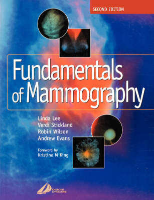 Fundamentals of Mammography - Sue Williams, Linda Lee, Verdi Stickland, A. Robin M. Wilson, Andrew Evans