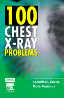 100 Chest X-Ray Problems - Jonathan Corne, Kate Pointon