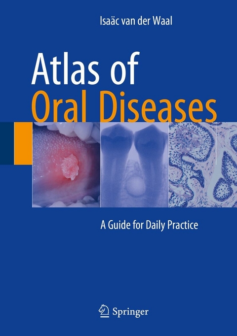 Atlas of Oral Diseases -  Isaäc van der Waal