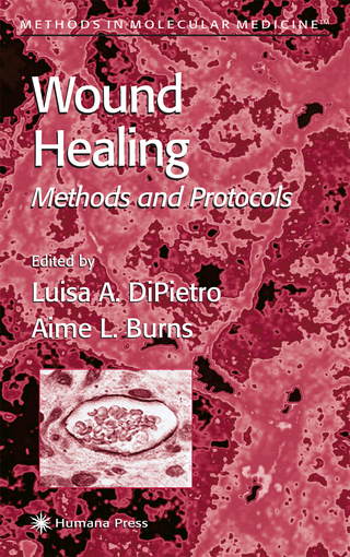 Wound Healing - Luisa A. DiPietro; Aime L. Burns